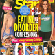 Illustration for article titled This Week In Tabloids: Bony Arms, Matchstick Legs and Eating Disorders